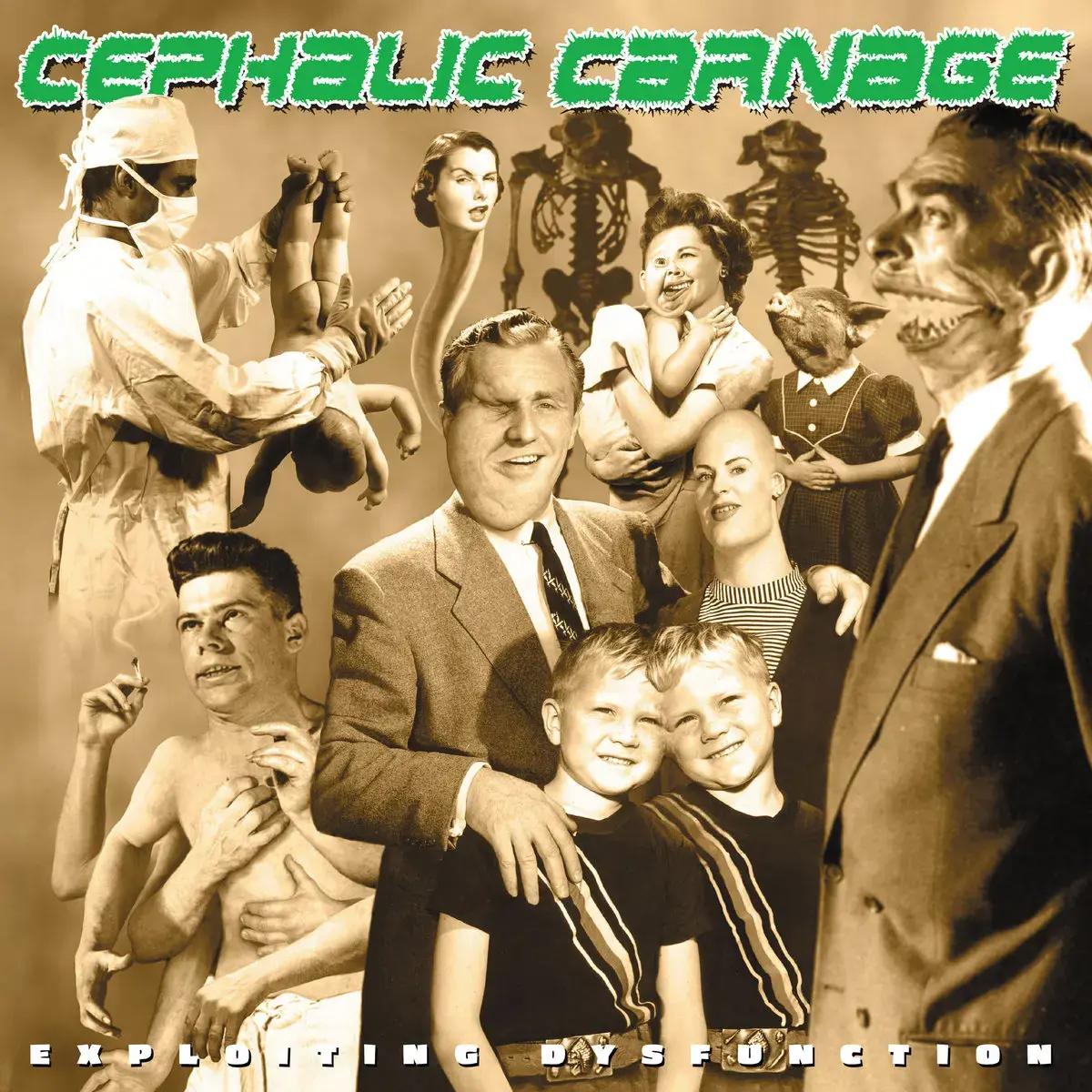 CEPHALIC CARNAGE - Exploiting Dysfunction (25th Anniversary) · 2CD (Death Metal CDs)